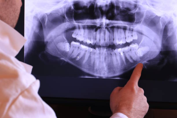 Best Emergency Dentist for Lost Fillings or Crowns in Uvalde Estates, TX