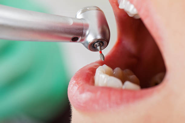 Best Emergency Dentist for Knocked-Out Tooth in Uvalde Estates, TX